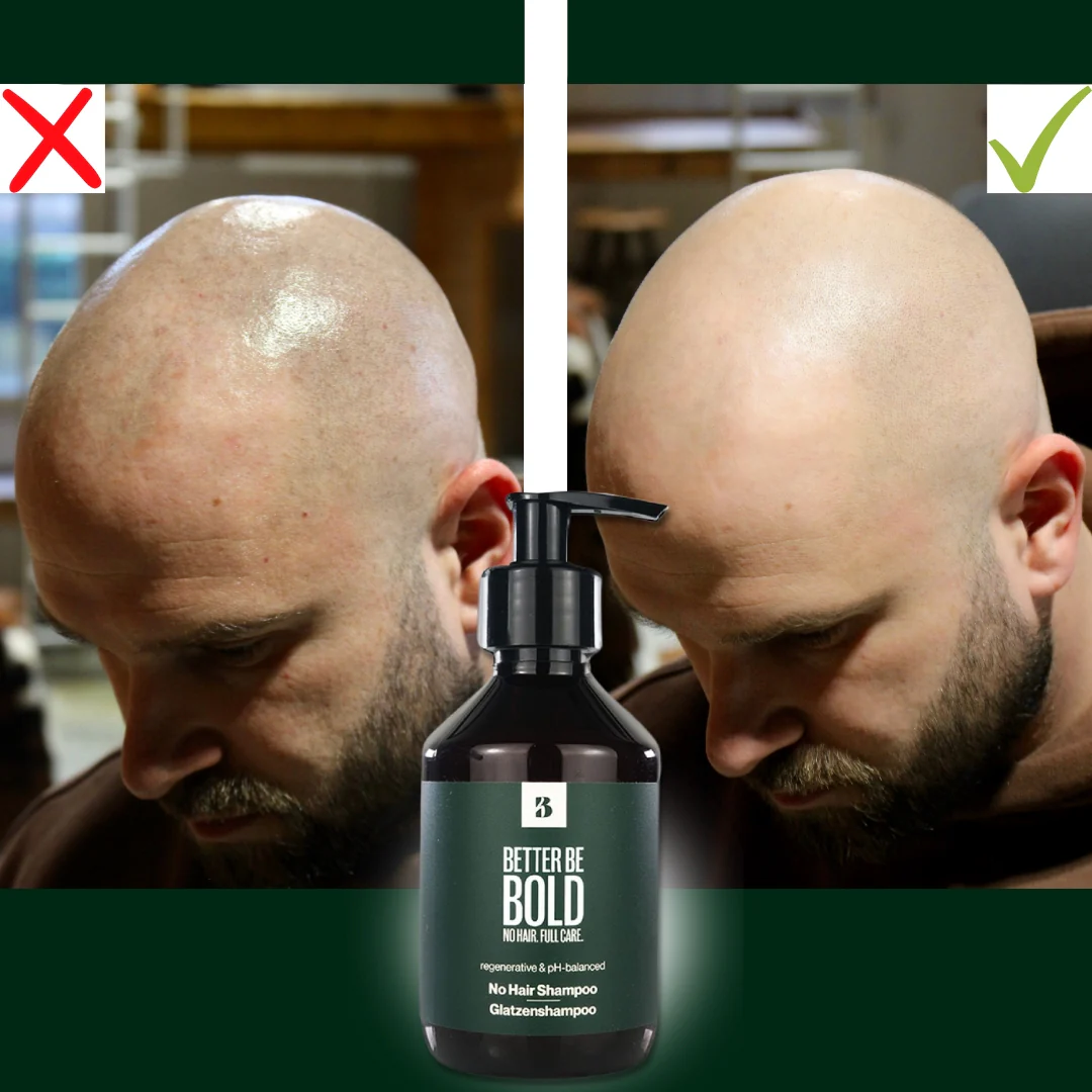 Glatzenshampoo | No Hair Shampoo - Image 8